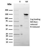 Leptin Receptor (LEPR)/Ob-R/CD295 Antibody in SDS-PAGE (SDS-PAGE)