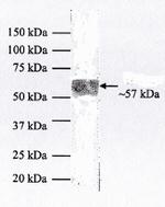 Cytokeratin 10 Antibody in Western Blot (WB)