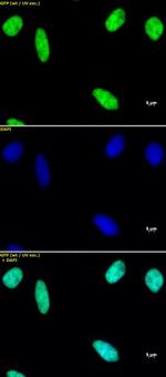 Histone macroH2A1 Antibody in Immunocytochemistry (ICC/IF)