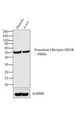 TACR1 Antibody in Western Blot (WB)