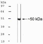 TACR1 Antibody in Western Blot (WB)