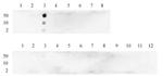 Histone H3K4me2 Antibody in Dot Blot (DB)