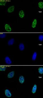 Histone H3K4me2 Antibody in Immunocytochemistry (ICC/IF)