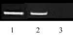 Histone H3K9me2 Antibody in ChIP Assay (ChIP)