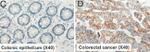 KLF6 Antibody in Immunohistochemistry (IHC)