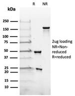 LH-beta (Luteinizing Hormone-beta) Antibody in SDS-PAGE (SDS-PAGE)