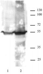 KLF4 Antibody in Western Blot (WB)