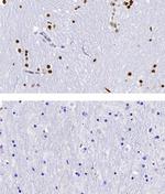 5-Hydroxymethylcytosine (5-hmC) Antibody in Immunohistochemistry (IHC)