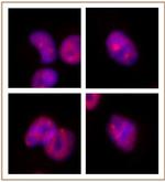 SMARCA2 / BRM Antibody in Immunocytochemistry (ICC/IF)