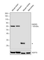 GAD65 Antibody in Western Blot (WB)