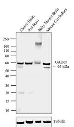 GAD65 Antibody in Western Blot (WB)
