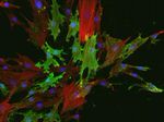 STRO-1 Antibody in Immunocytochemistry (ICC/IF)