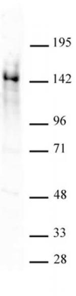 Ubn1 Antibody in Western Blot (WB)