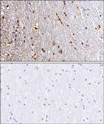 EZH2 Antibody in Immunohistochemistry (Paraffin) (IHC (P))