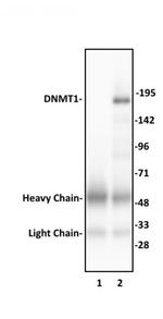 DNMT1 Antibody in Immunoprecipitation (IP)