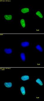 Histone H3K27me2 Antibody in Immunocytochemistry (ICC/IF)