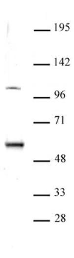 ELP3 Antibody in Western Blot (WB)