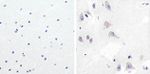 GSK3B Antibody in Immunohistochemistry (Paraffin) (IHC (P))