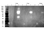 HER2 Fab Antibody in Western Blot (WB)