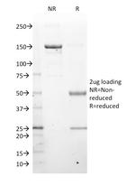 LMO2 (B-Cell Marker) Antibody in SDS-PAGE (SDS-PAGE)