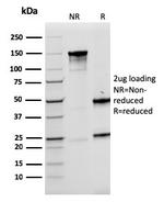 LMO2 Antibody in SDS-PAGE (SDS-PAGE)