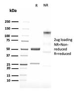 LMO2 Antibody in SDS-PAGE (SDS-PAGE)