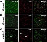 ZO-1 Antibody in Immunohistochemistry (IHC)