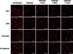 ZO-1 Antibody in Immunocytochemistry (ICC/IF)