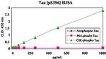 Human Tau (Phospho) [pS396] ELISA Kit