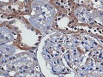 TXNIP Antibody in Immunohistochemistry (IHC)