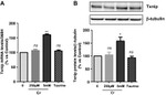 TXNIP Antibody in Western Blot (WB)