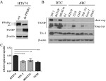 TXNIP Antibody in Western Blot (WB)