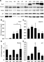 JPH1 Antibody in Western Blot (WB)