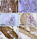 JPH1 Antibody in Immunohistochemistry (IHC)