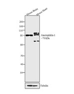 JPH2 Antibody in Western Blot (WB)