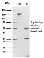 Lactotransferrin/Lactoferrin/LTF Antibody in SDS-PAGE (SDS-PAGE)