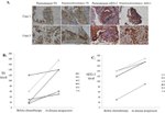 Metadherin Antibody in Immunohistochemistry (IHC)