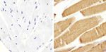 Metadherin Antibody in Immunohistochemistry (Paraffin) (IHC (P))