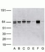 Metadherin Antibody in Western Blot (WB)