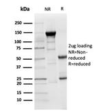 Lysozyme (Histiocytoma andMonocytic Acute Leukemia Marker) Antibody in Immunohistochemistry (Paraffin) (IHC (P))