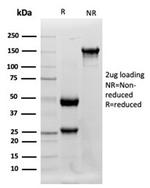 Lysozyme (Histiocytoma andMonocytic Acute Leukemia Marker) Antibody in Western Blot (WB)