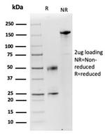 Lysozyme (Histiocytoma and Monocytic Acute Leukemia Marker) Antibody in SDS-PAGE (SDS-PAGE)