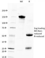 TACSTD2/TROP2 Antibody in SDS-PAGE (SDS-PAGE)