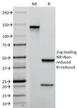 TACSTD2/TROP2 Antibody in SDS-PAGE (SDS-PAGE)