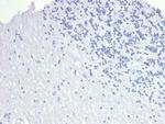 TACSTD2/TROP2 Antibody in Immunohistochemistry (Paraffin) (IHC (P))