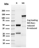 TACSTD2/TROP2 Antibody in SDS-PAGE (SDS-PAGE)