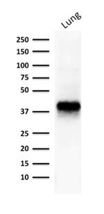 Ep-CAM/CD326 (Extracellular Domain) (Epithelial Marker) Antibody in Western Blot (WB)