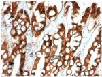 Ep-CAM/CD326 (Extracellular Domain) (Epithelial Marker) Antibody in Immunohistochemistry (Paraffin) (IHC (P))