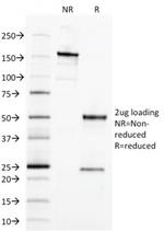 Ep-CAM/CD326 (Extracellular Domain) (Epithelial Marker) Antibody in SDS-PAGE (SDS-PAGE)