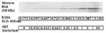 Human AKT (Phospho) [pS473] ELISA Kit